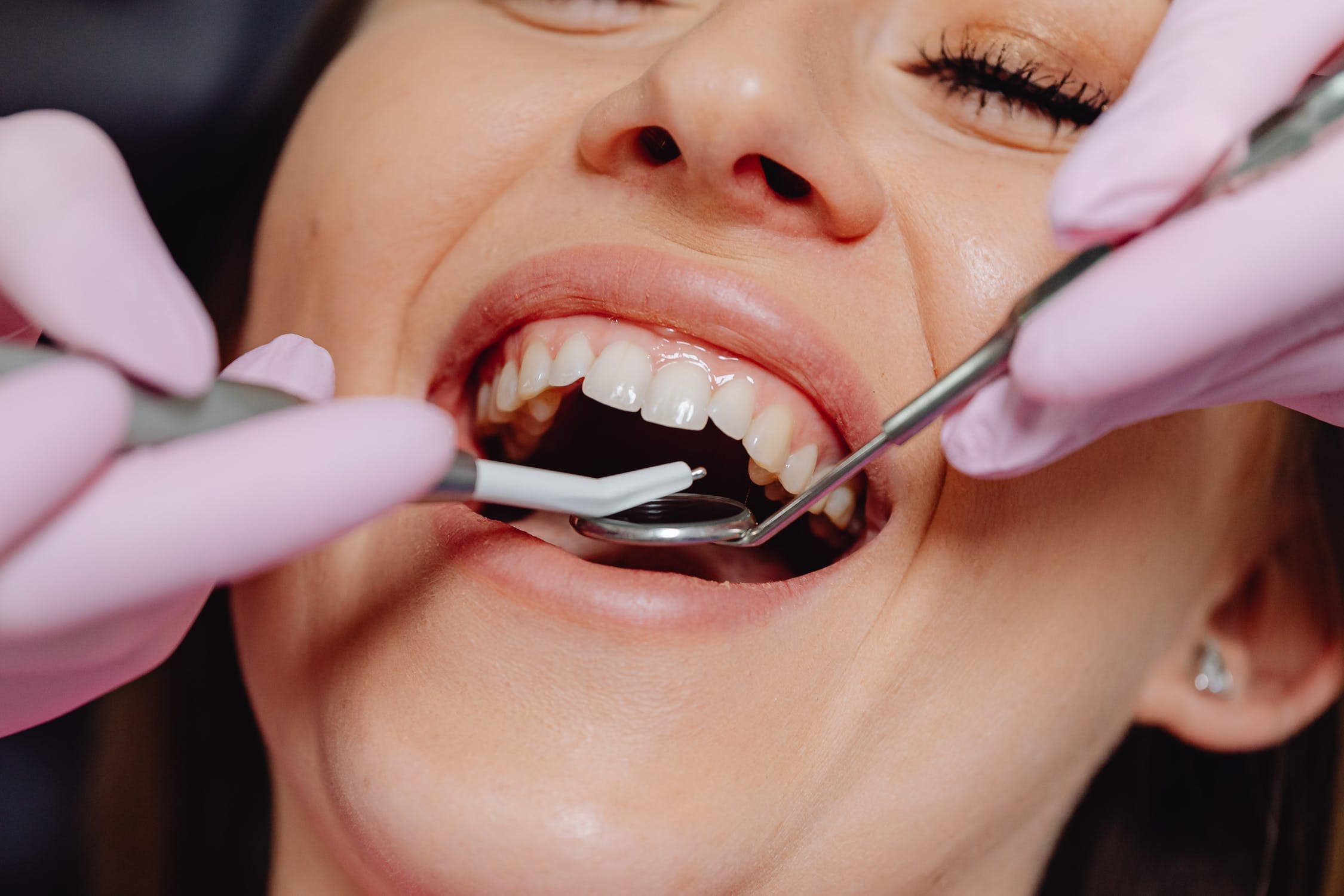 Valley Stream Periodontal Surgery