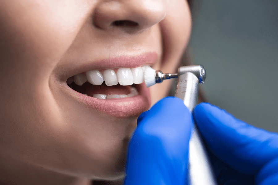 Valley Stream Dental Exam And Cleaning