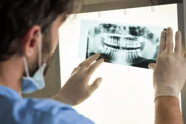 Valley Stream Dental X-Rays