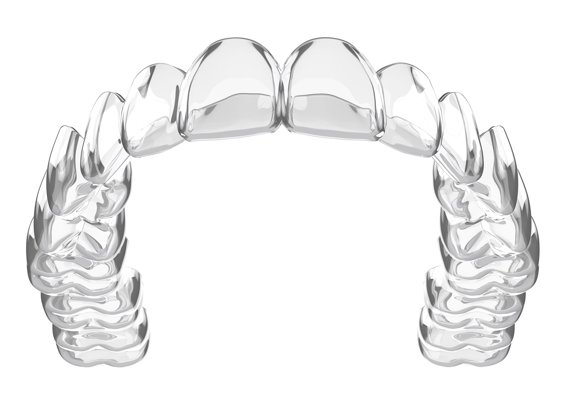 Clear Aligners for Overbite: What You Should Know